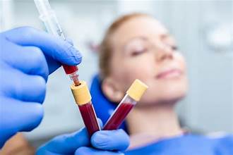 PRP Treatment Dubai